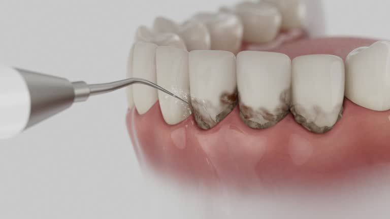 Reliable Emergency Dentist contractor in Santa Barbara, CA by Smile Center Dentistry